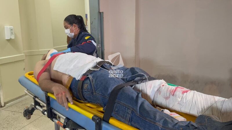 Motociclista sofre fratura exposta após grave acidente na Transacreana, em Rio Branco