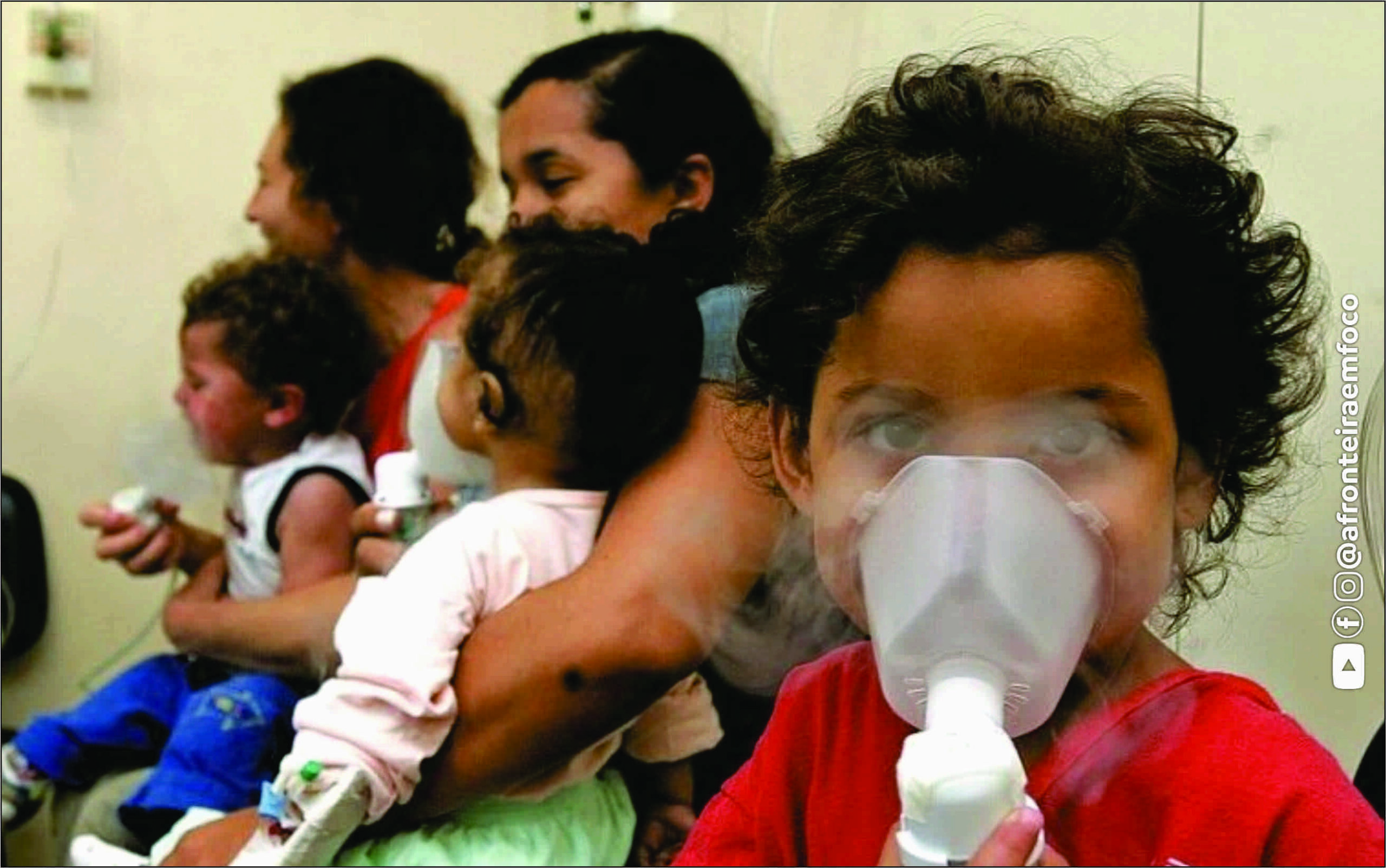 Síndromes respiratórias causam 43 mortes no Acre em 2026; óbitos de crianças menores de 2 anos atingem maior patamar dos últimos três anos