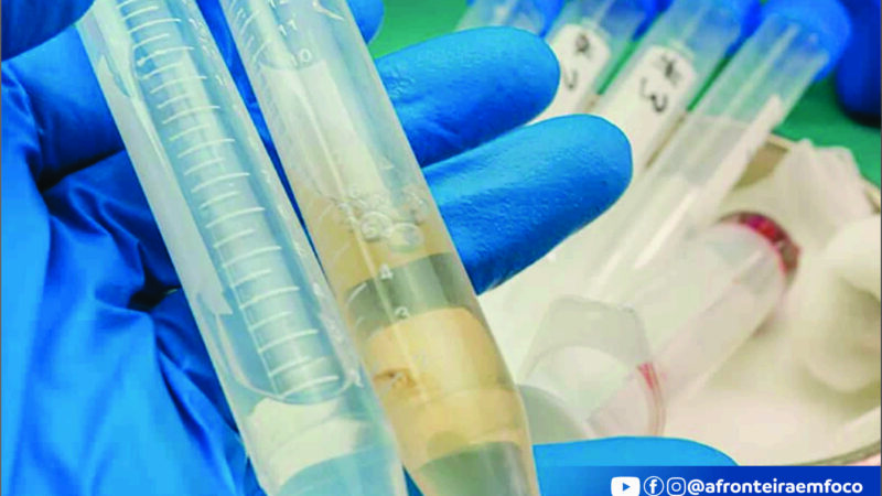 Acre registra 13 casos confirmados de meningite e um óbito em 2026, aponta Sesacre